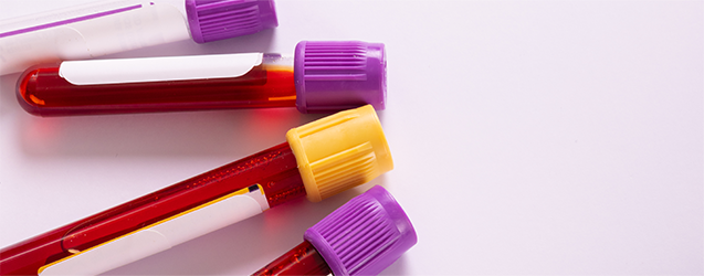 임신 혈액검사 이미지